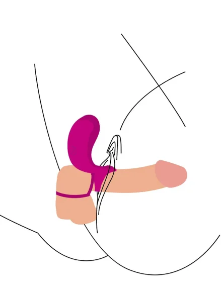 Couples Stimulator Ring - Penisring med vibrator 0