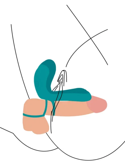 Couples Vibrator Ring - Penisring med vibrator 0